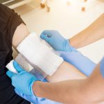 What Compensation Can You Recover for a Burn Injury in Pennsylvania?