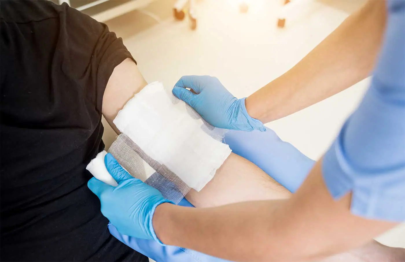 What Compensation Can You Recover for a Burn Injury in Pennsylvania?